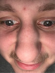 Zach Shack